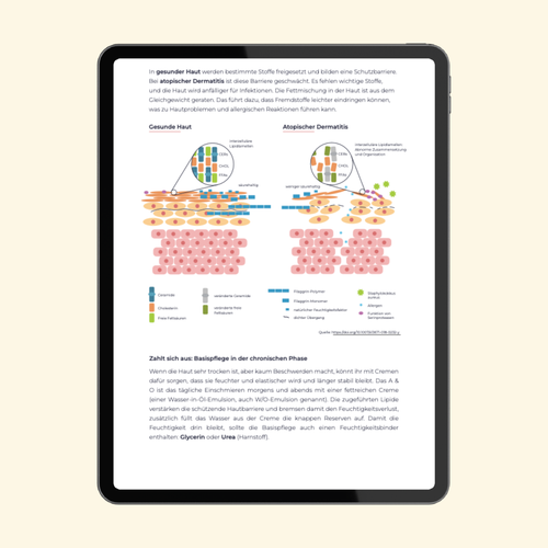 Neurodermits-Ratgeber bei Kindern: Verstehen und richtig behandeln (17 Seiten)